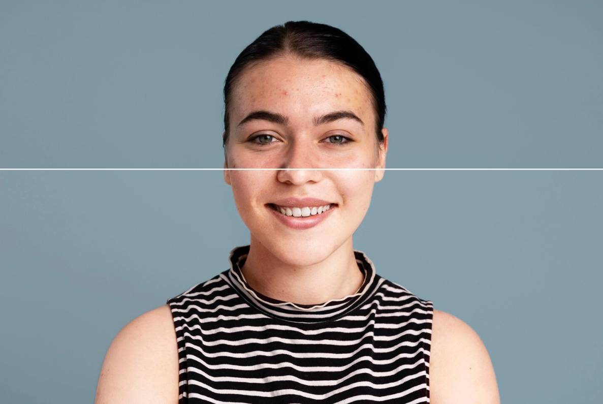 درمان جوش و لک دکتر امین جعفری..