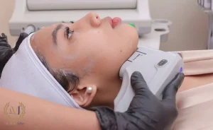 مزیت های هایفو