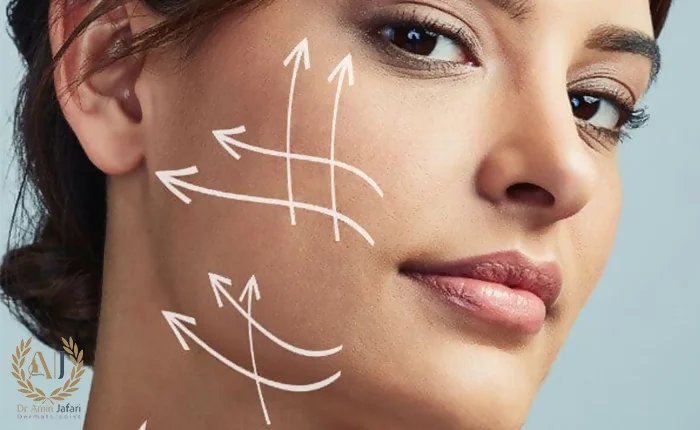 جلسات درمانی هایفو و اندولیفت