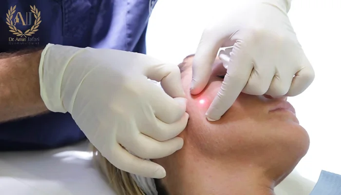 مزایای اندولیفت