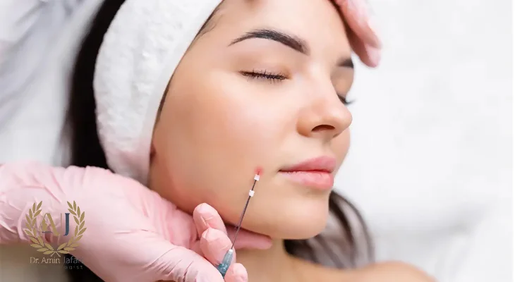 جلسات لیزر اندولیفت