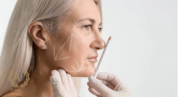 عوامل ماندگاری اندولیفت