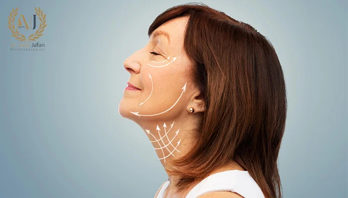 کاندیدای مناسب لیفت صورت با نخ