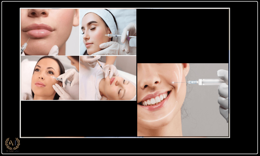 تخلیه ژل نواحی مختلف