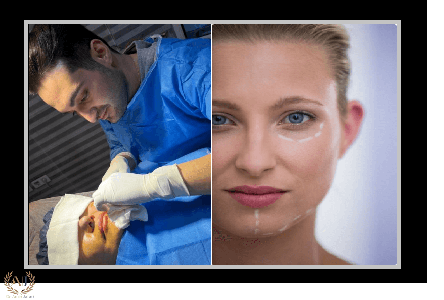 نکروز چست درمان انواع نکروز