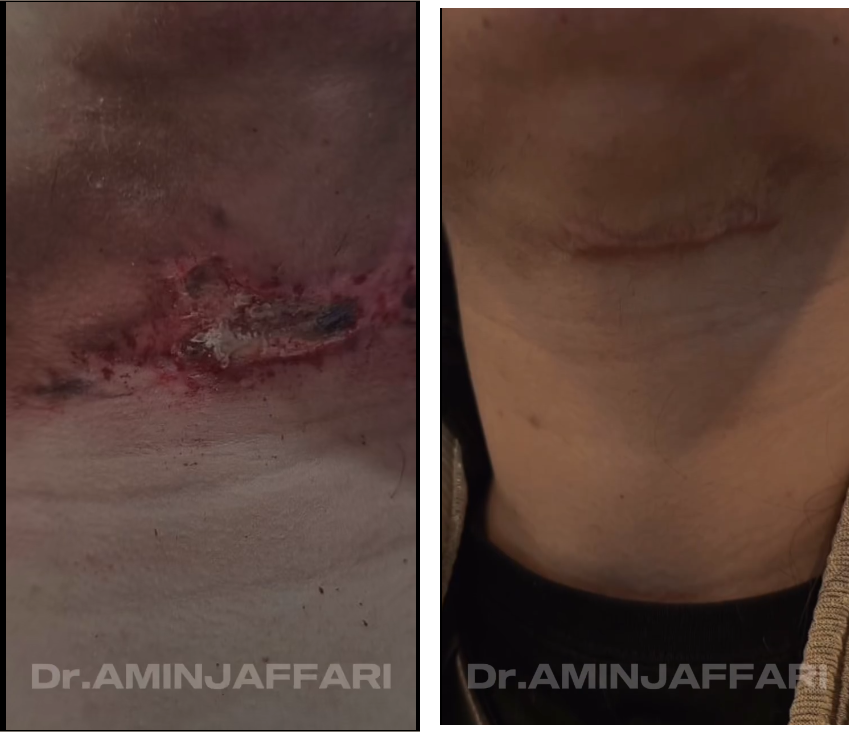 ترمیم بافت آسیب دیده .