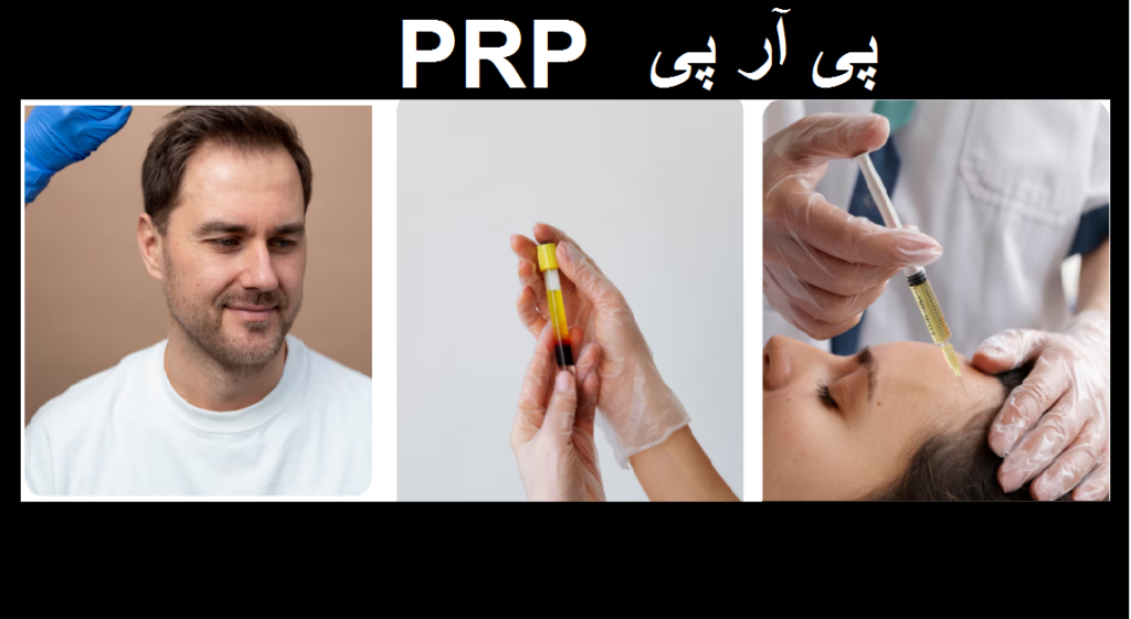 پی آر پی PRP