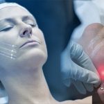 اندولیفت نخ (5)