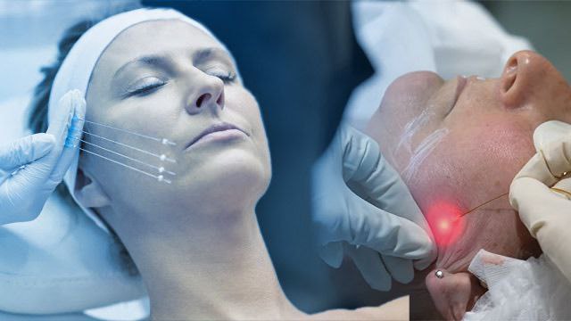 اندولیفت نخ (5)