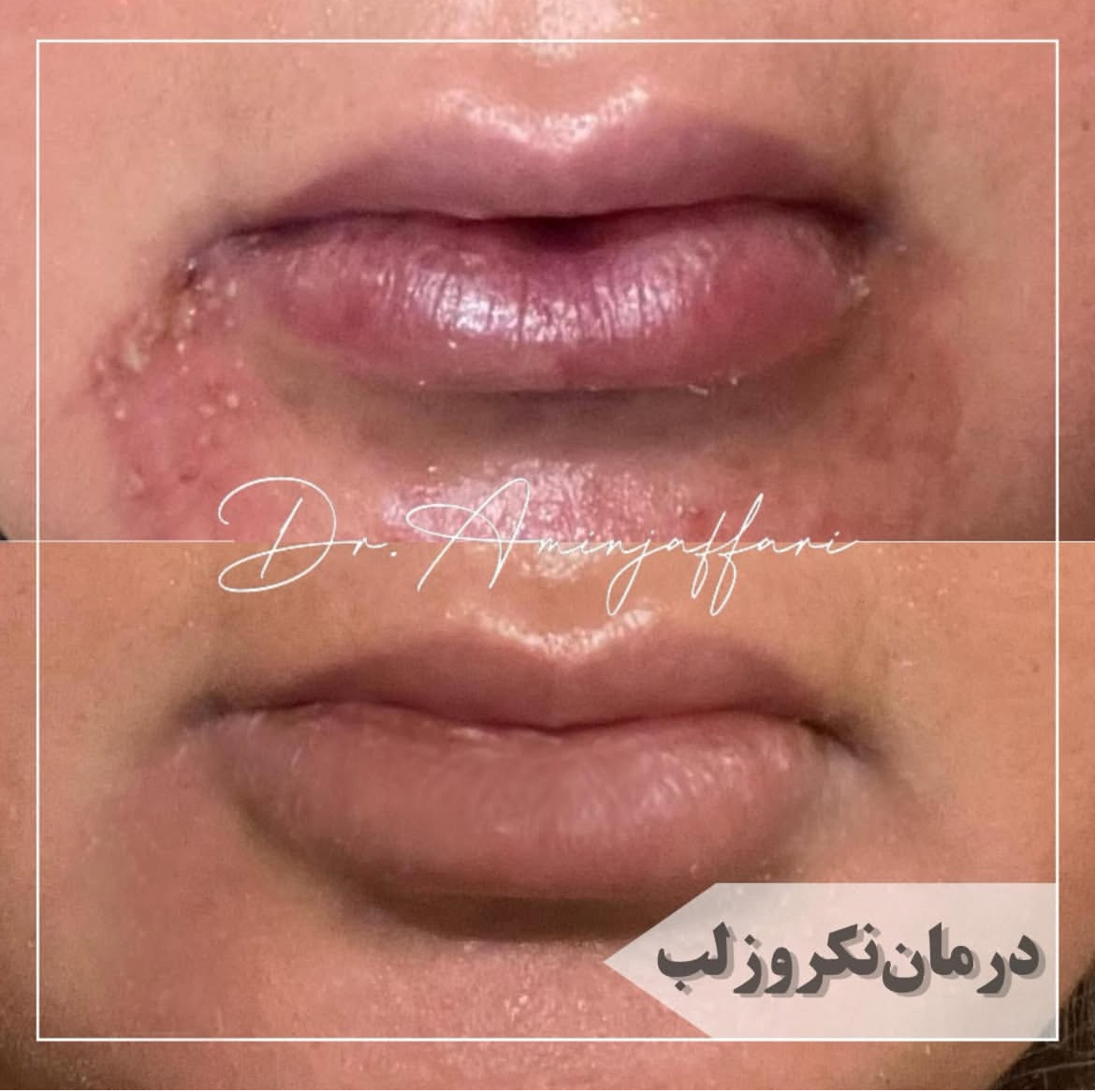 ترمیم بافت آسیب دیده دکتر امین جعفری (1)