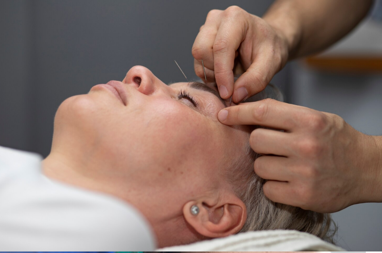 خارج سازی نخ لیفت و امبدینگ