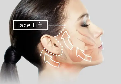 "۵ مرحله درمان اندولیفت صورت: از شروع تا نتایج نهایی"