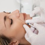 فالوآپ تخلیه فیلر خط خنده: راهنمای کامل مراقبت، اصلاح و پیشگیری از عوارض