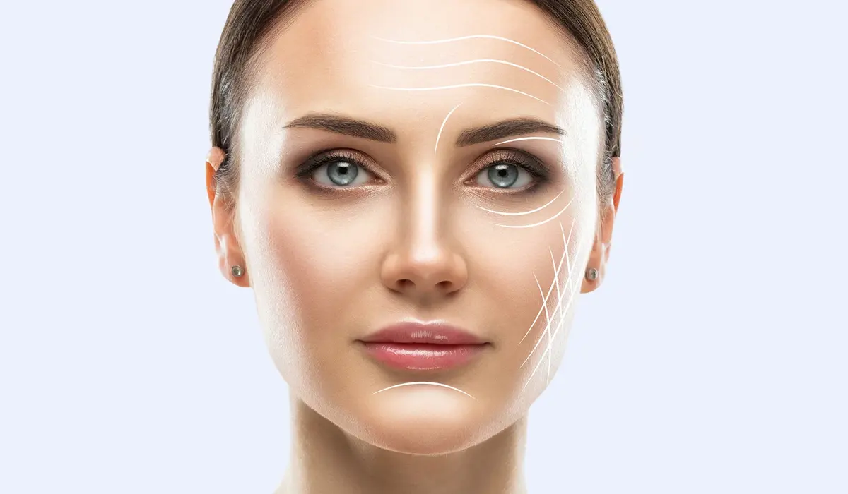 لیپوفیس چیست؟ کانتورینگ صورت بدون اغراق