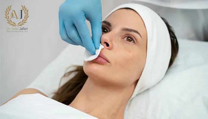 تخلیه ژل لب بدون جراحی باز؛ روش آندوسکوپیک دکتر جعفری چیست؟