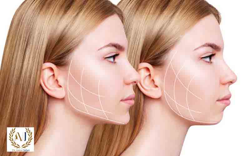 لیپوفیس چیست و چرا انتخابی هوشمندانه است؟