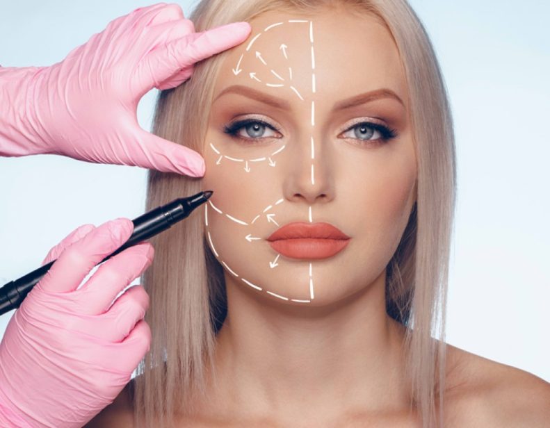 "۵ مرحله درمان اندولیفت صورت: از شروع تا نتایج نهایی"